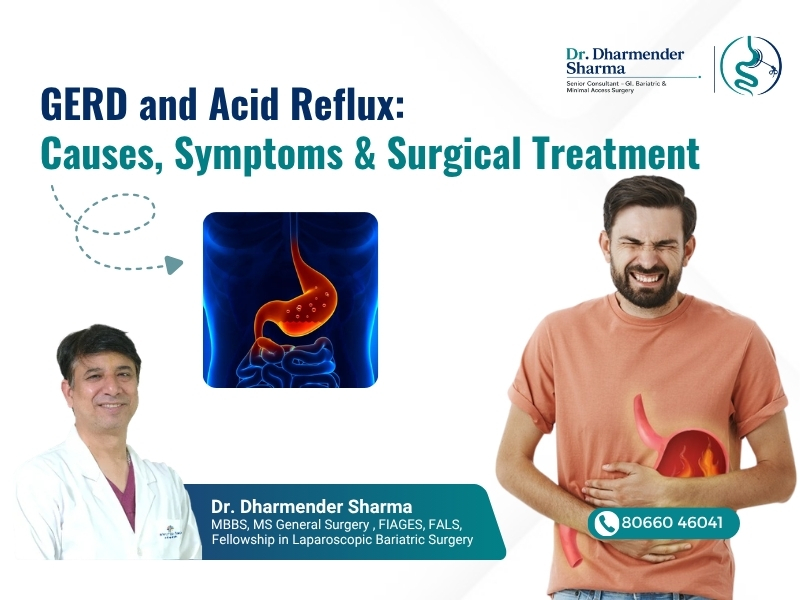 GERD and acid reflux treatment awareness image by Dr. Dharmender Sharma in Gurugram