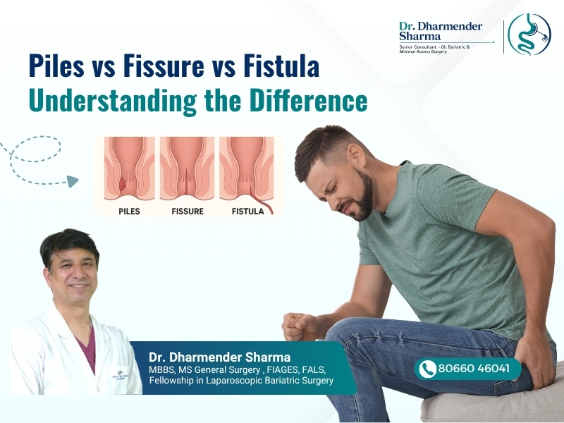 Piles vs fissure vs fistula comparison image by Dr. Dharmender Sharma in Gurugram