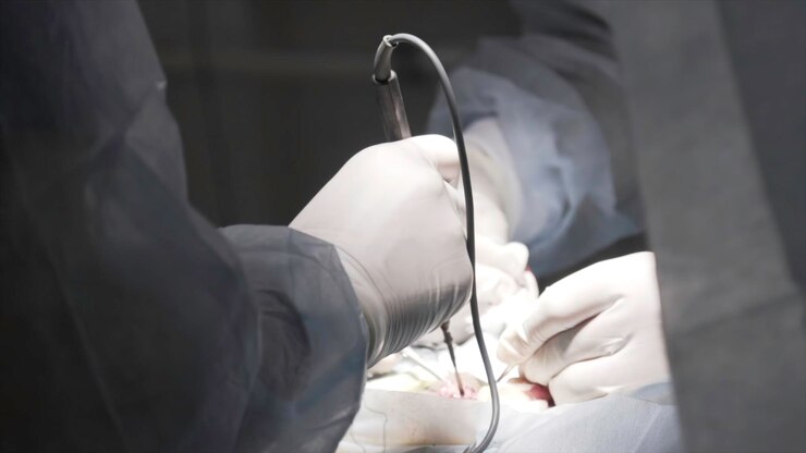 Advanced laparoscopic surgery procedure performed by Dr. Dharmender Sharma in Gurugram